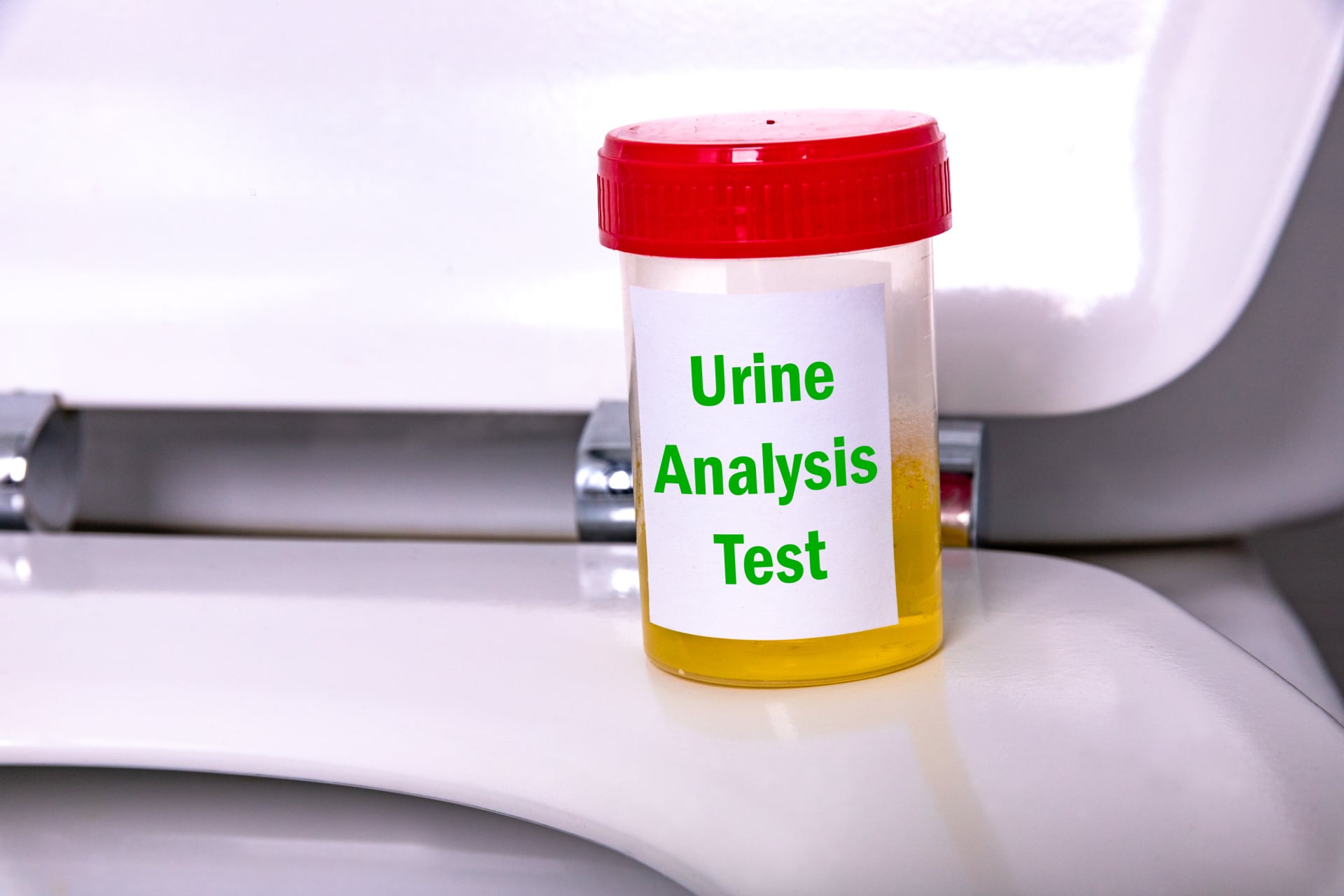 Workplace drug testing urinalysis cup on edge of toilet, testing for THC.